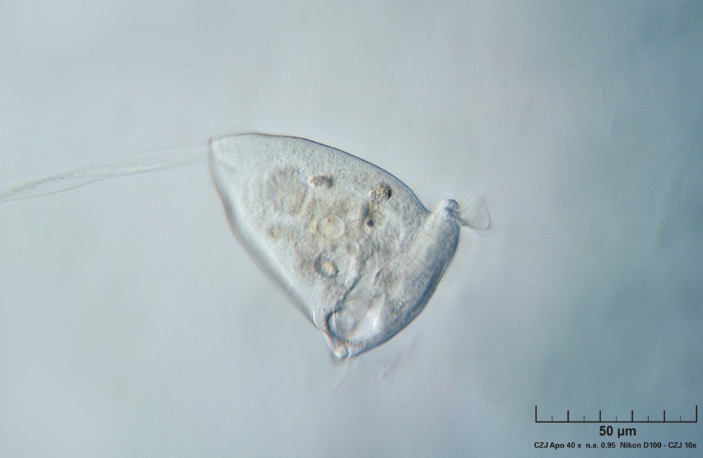 Vorticella